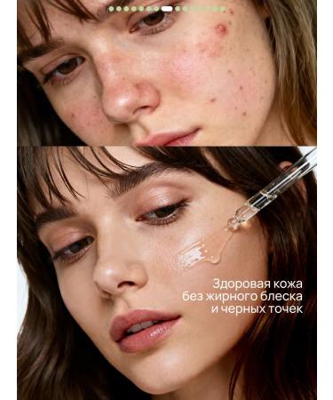 Semily Facial serum against acne with niacinamide - Buy Online on GoSupps.com