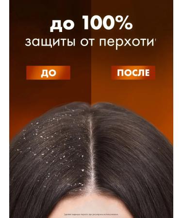 Clear Women's hair shampoo from dandruff from falling out 500 ml - Buy Online on GoSupps.com