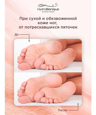 HydroBionique by Doctor Ocean Cream for legs with urea - Buy Online on GoSupps.com