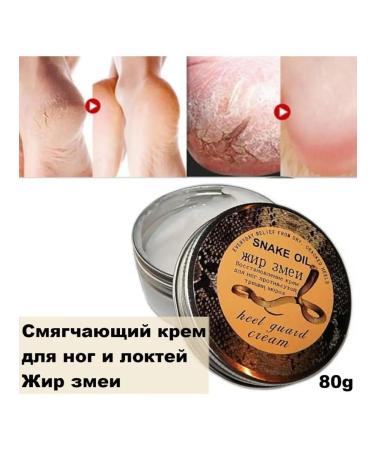 pharmacy Cream for the skin of the arms and legs