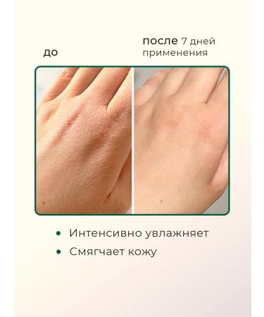 EKEL Moisturizing hand cream with aloe - Buy Online on GoSupps.com