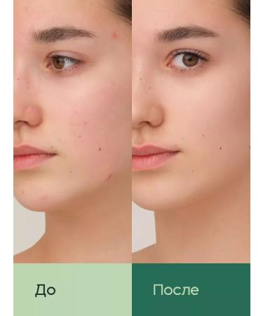 Lavant Pimples from acne with centella for problem skin - Buy Online on GoSupps.com