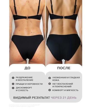 EVSI Shower gel is acidic acid from acne - Buy Online on GoSupps.com