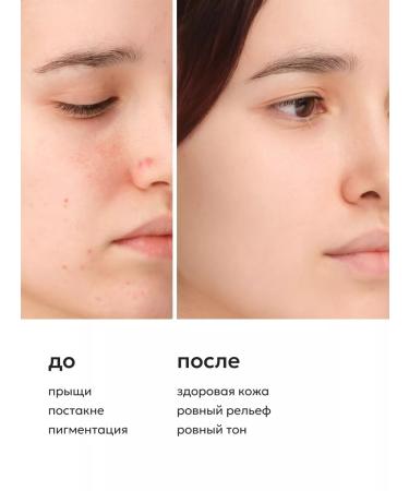 Likato professional Facial cream from acne and acne for daily care - Buy Online on GoSupps.com