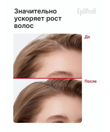 EpilProfi Hair growth mask and from pepper 500 ml - Buy Online on GoSupps.com