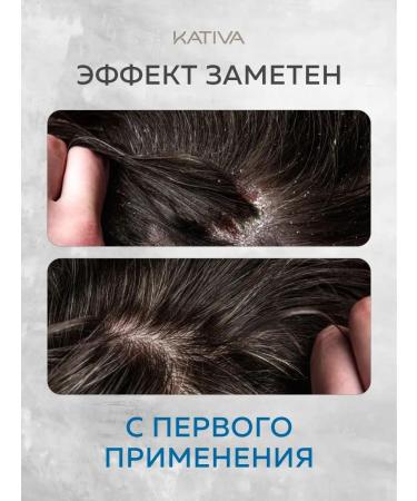 Kativa Healing shampoo for oily hair from dandruff with climonon - Buy Online on GoSupps.com