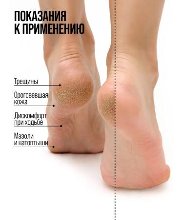 7DAYS Leg cream with urea from cracks and corns moisturizers - Buy Online on GoSupps.com