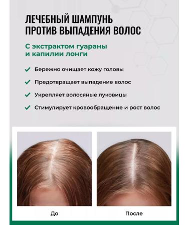 HIPERTIN Hair dropping shampoo medical professional - Buy Online on GoSupps.com