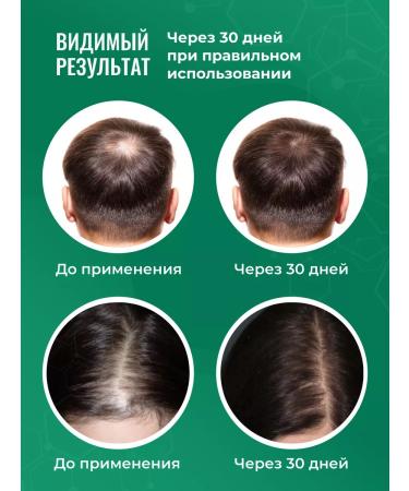 HIPERTIN Hair dropping shampoo medical professional - Buy Online on GoSupps.com