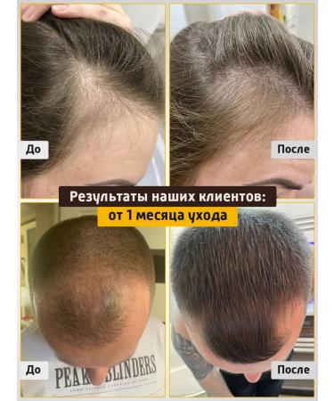 Dari cosmetics Pilling shampoo hair mask 3pcs - Buy Online on GoSupps.com