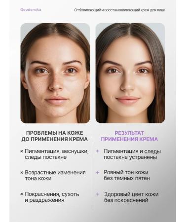 Geodemics Face cream moisturizer from pigmentation - Buy Online on GoSupps.com