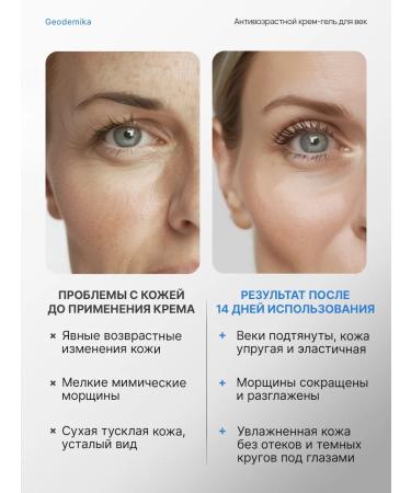 Geodemics Eye gel cream with Sklavan and caffeine 30 ml - Buy Online on GoSupps.com