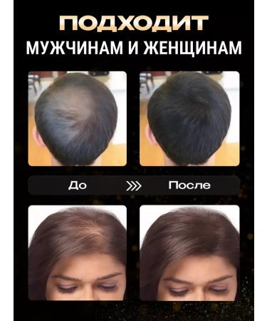 FULLY Hair thickener in the Medium Brown package (chestnut) 25 g - Buy Online on GoSupps.com