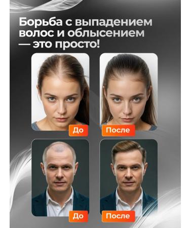 Xinoxin xynsin -lotion for hair growth 5% 60ml - 3 pcs - Buy Online on GoSupps.com