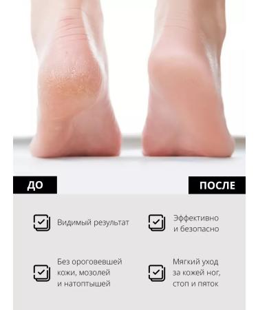 Blacknails Sanding abrasive caps for pedicure 240grit set 10pcs - Buy Online on GoSupps.com