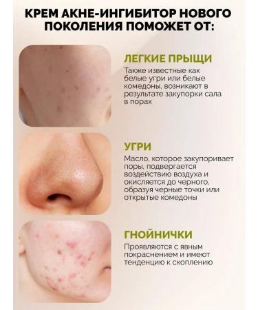 SunQUEEN Niacinamide cream against acne acne and black dots - Buy Online on GoSupps.com