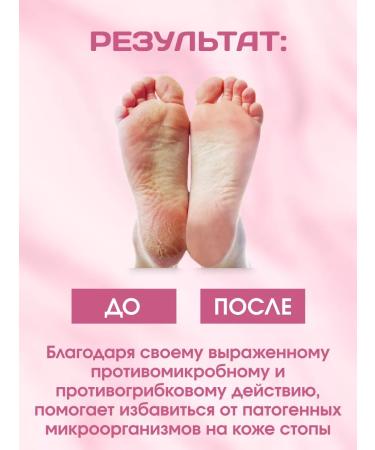 Springs of Siberia Feet balm cream from the fungus 60 g - Buy Online on GoSupps.com