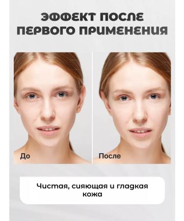 Vitex Face sling Vitamin 75 ml - Buy Online on GoSupps.com