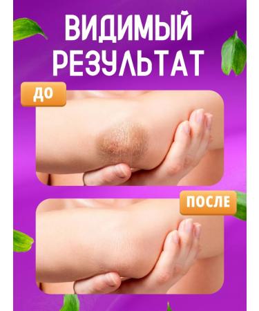 EVO Cream for elbows and knees clarifying 2 pcs 46 ml - Buy Online on GoSupps.com