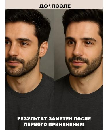 SAVACE & HERBS Shampoo against dandruff 250 ml - Buy Online on GoSupps.com