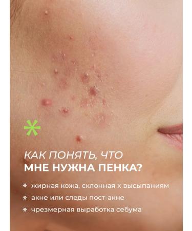 Seauty Foam for washing the face from acne and acne 150 - Buy Online on GoSupps.com