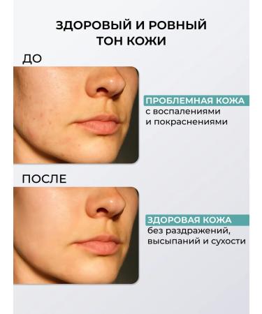 Greenini Pilling slot for problem and oily skin - Buy Online on GoSupps.com