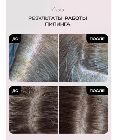 Verdad Piling for the scalp of hair acid professional - Buy Online on GoSupps.com
