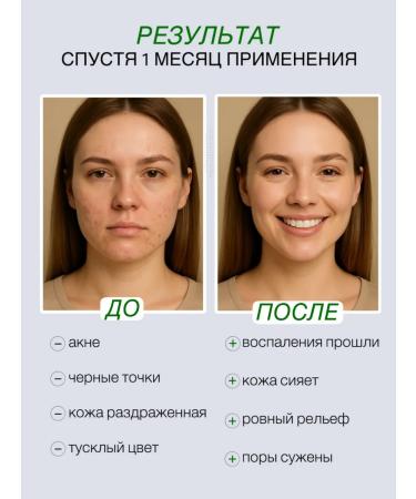 Theorem Facial serum from acne and post -acne - Buy Online on GoSupps.com