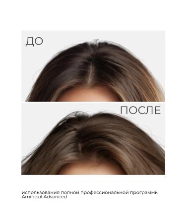 L'Oreal Professionnel Aminexil Advanced 5 6  - Buy Online on GoSupps.com