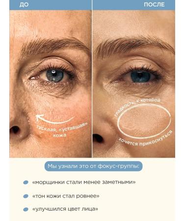 VOIS Face serum from wrinkles retinol 30 ml - Buy Online on GoSupps.com