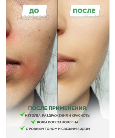 Dr Jart+ Sedeemer with aloe vera 5 pcs - Buy Online on GoSupps.com