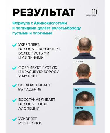 11i professional Hair growth serum. Against falling out and baldness - Buy Online on GoSupps.com