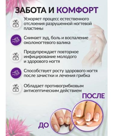 SAGITTA Stop oil onicholysis - Buy Online on GoSupps.com