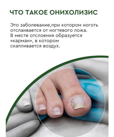 INKI Lotion antifungal for nails Stop Oniholyisis No. 1 - Buy Online on GoSupps.com