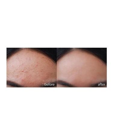 A'Pieu Restorative cream - Buy Online on GoSupps.com