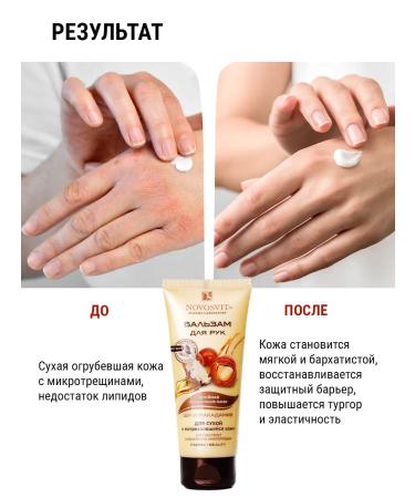 Novosvit Balm for dry skin of hands 100 ml (3 pcs) - Buy Online on GoSupps.com