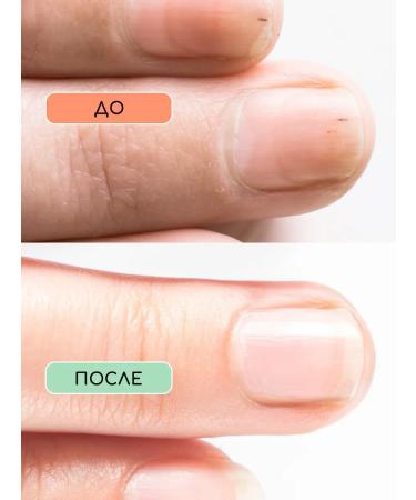 INKI Strengthening gel to clarify nails with AHA acids - Buy Online on GoSupps.com