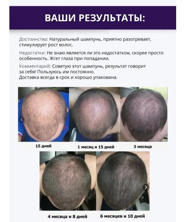 DR MARCUS HEILER Shampoo for hair growth with red pepper and zinc - Buy Online on GoSupps.com