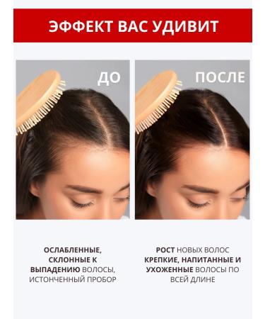 DR MARCUS HEILER Shampoo for hair growth with red pepper and zinc - Buy Online on GoSupps.com