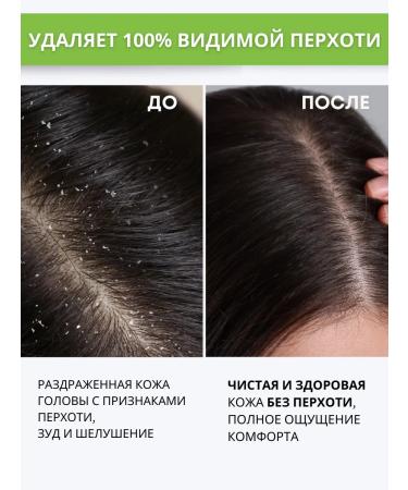 DR MARCUS HEILER Shampoo from dandruff and seborrhea for oily hair zinc clumbazole - Buy Online on GoSupps.com