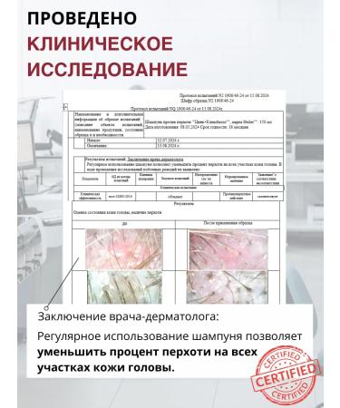 DR MARCUS HEILER Shampoo from dandruff and seborrhea for oily hair zinc clumbazole - Buy Online on GoSupps.com