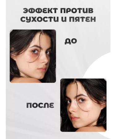 Vitex Aloe gel carpet 97% 7 in 1 for the face hands and body 150 ml - Buy Online on GoSupps.com