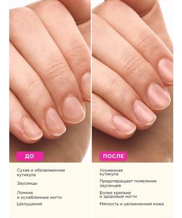 VOIS Oil for cuticle and nails pencil 5 ml with a brush - Buy Online on GoSupps.com