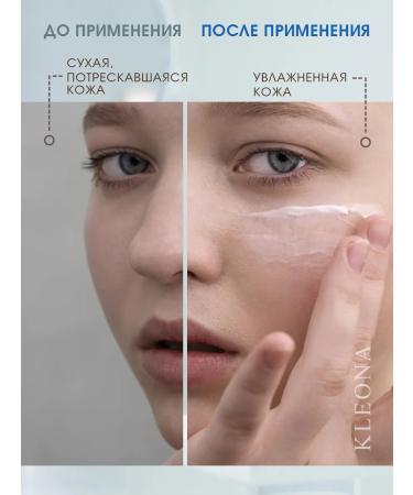 KLEONA Facial cream moisturizing day hypoallergenic Sensitive - Buy Online on GoSupps.com