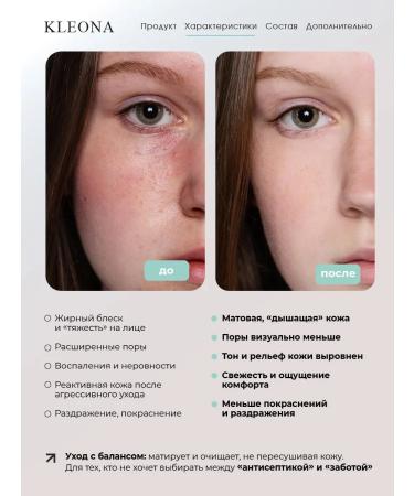 KLEONA Facial serum from pimples seborrching 14+ - Buy Online on GoSupps.com