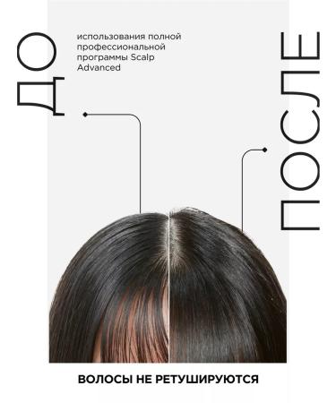 L'Oreal Professionnel Scalp Advanced shampoo for sensitive scalp - Buy Online on GoSupps.com