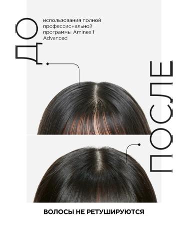 L'Oreal Professionnel AMINEXIL ADVANCED whey against hair loss 90 ml - Buy Online on GoSupps.com