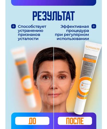 Novosvit Skin cream around the eyes with vitamin C 20 ml - Buy Online on GoSupps.com