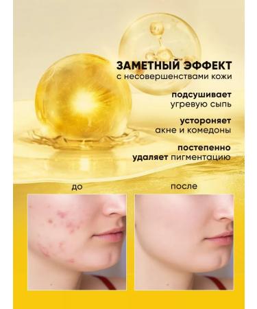 YALMA Placenta hydrolyzate - face serum 20 ml. - 1pc - Buy Online on GoSupps.com