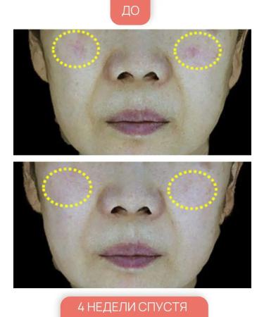 Cosrx Witamin C Serum Witamin C serum - Buy Online on GoSupps.com